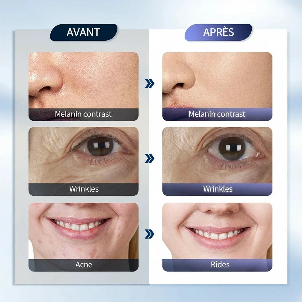 Variantes de prises EU • UK • US • AU pour masque LED 7 couleurs