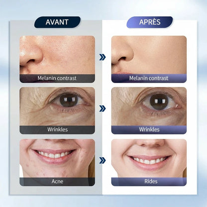 Variantes de prises EU • UK • US • AU pour masque LED 7 couleurs